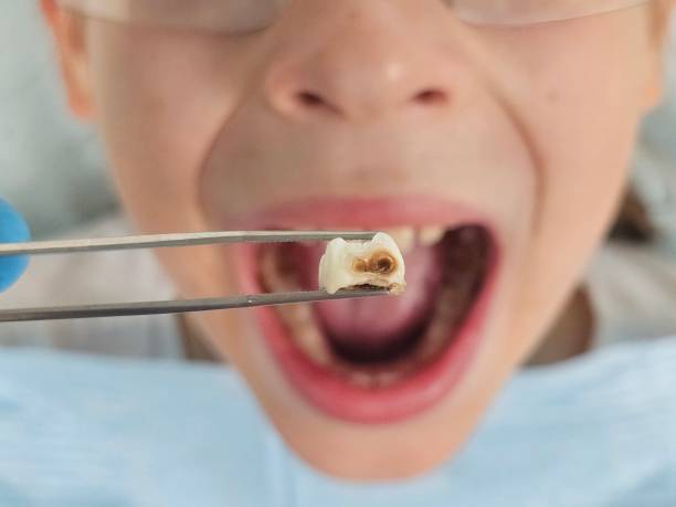 Best Pediatric Emergency Dentist in Cameron Park, TX