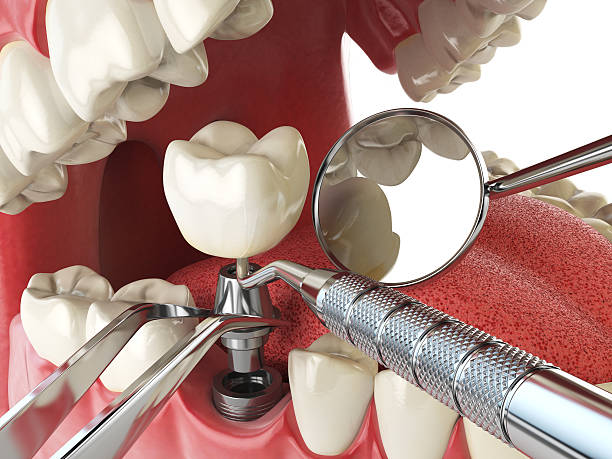 Best Weekend Emergency Dentist in Cameron Park, TX
